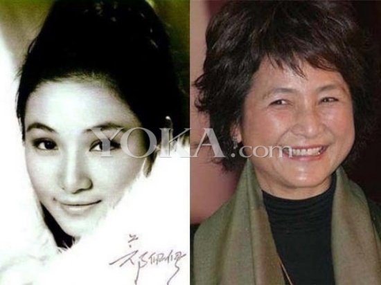 盘点国内国外知名女星容貌巨大变化