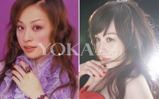 盘点国内国外知名女星容貌巨大变化