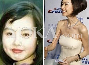 盘点国内国外知名女星容貌巨大变化